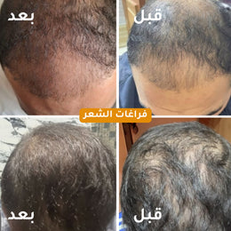 Hair Oil - زيت الشعر