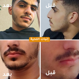 Hair Oil - زيت الشعر