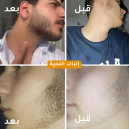 Hair Oil - زيت الشعر