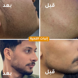 Hair Oil - زيت الشعر